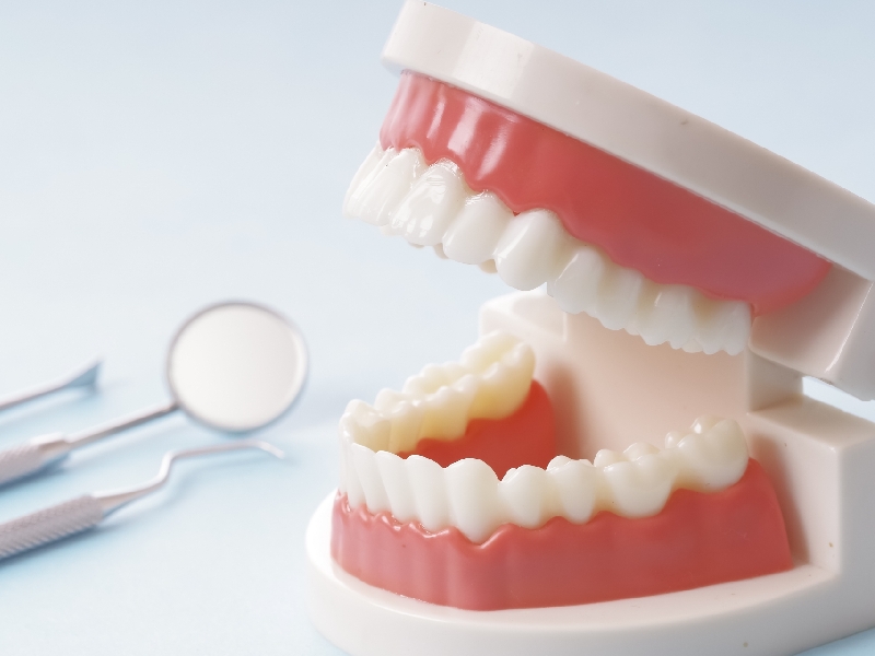 予防歯科について